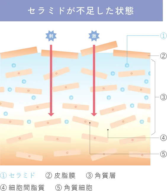 セラミドが不足した状態の肌