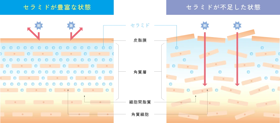 セラミドが豊富な状態の肌と、セラミドが不足した状態の肌の比較図